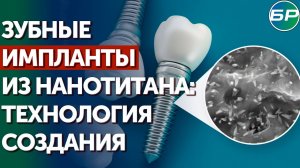 Нанотитан: ученые из Уфы разработали зубные импланты, которые приживаются в два раза быстрее