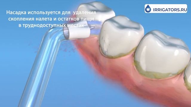 Имплантологическая насадка Waterpik PS-100E смотреть онлайн