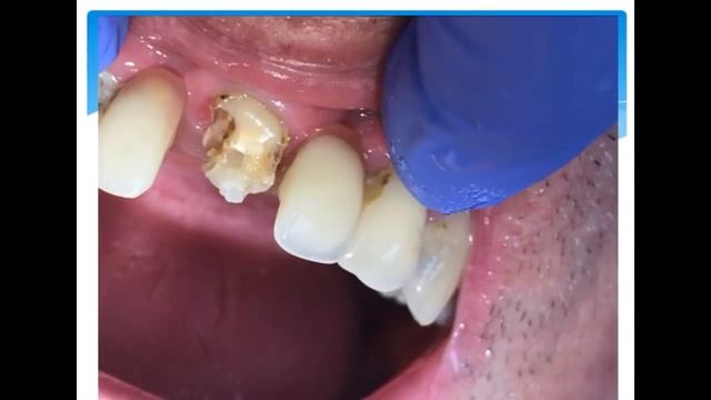 Как вырастить зуб за один час смотреть онлайн