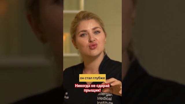 Никогда не делай этого с прыщами!! #рубцы #постакне #акне #рубцыналице #прыщиналице #прыщ смотреть онлайн