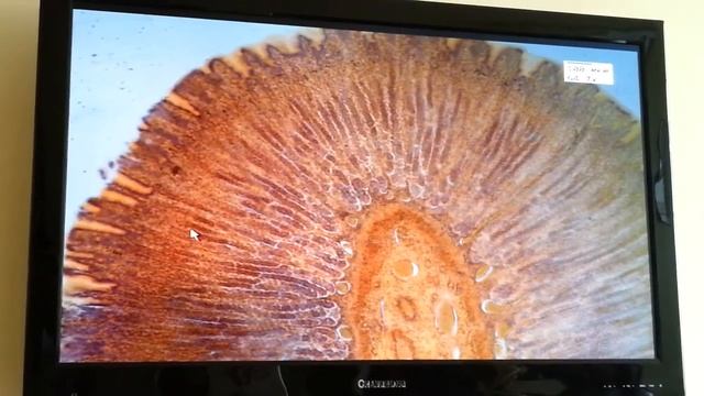 Гистология Дно желудка [Пищеварительная система] смотреть онлайн