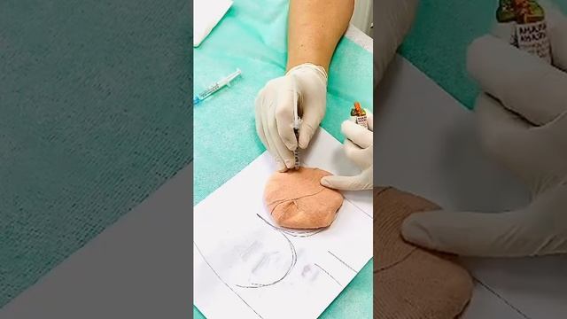 Как сбить температуру ребёнку (уколы, препараты от высокой температуры 38 39 40 градусов). смотреть онлайн