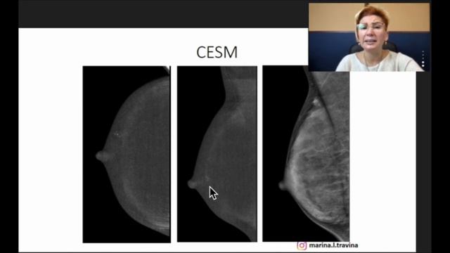 Маммология для врачей. Лучевая диагностика