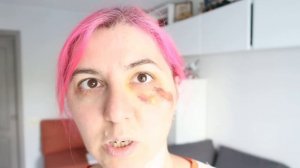 Убрать синяк и отек за 5 минут