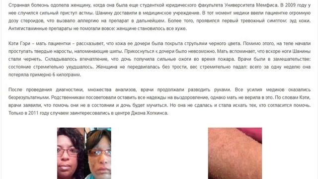 Женщина мутант: Моя Ужасная История смотреть онлайн