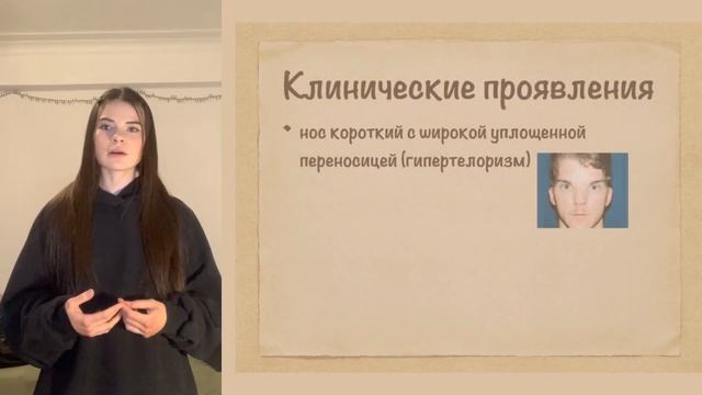 Синдром Дауна смотреть онлайн