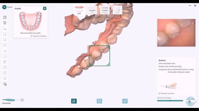 BLZ Dental Intraoral Scanner INO100 Fast Scanning Experience смотреть онлайн