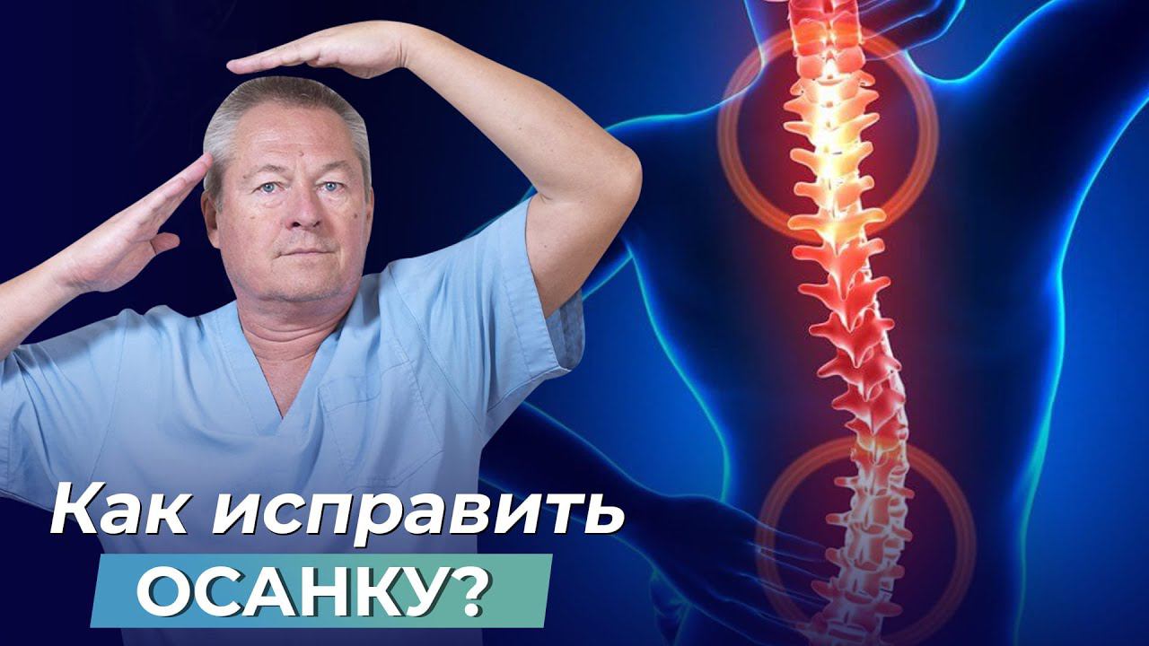 ИСПРАВЛЯЕМ ОСАНКУ. САМЫЙ ДЕЙСТВЕННЫЙ СПОСОБ смотреть онлайн
