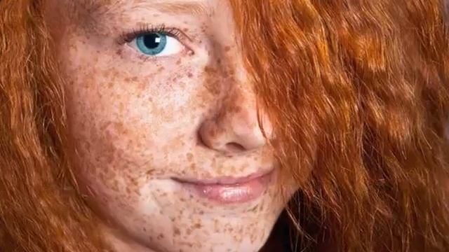 Почему летом у человека появляются веснушки смотреть онлайн