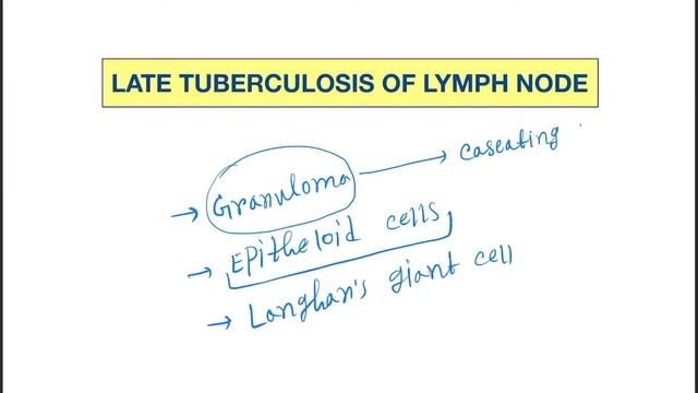 Late tuberculosis of lymph node Histopathology features смотреть онлайн