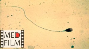 Сперматозоиды, эякулят, мужские половые клетки © Male sex cells, ejaculate, spermatozoa