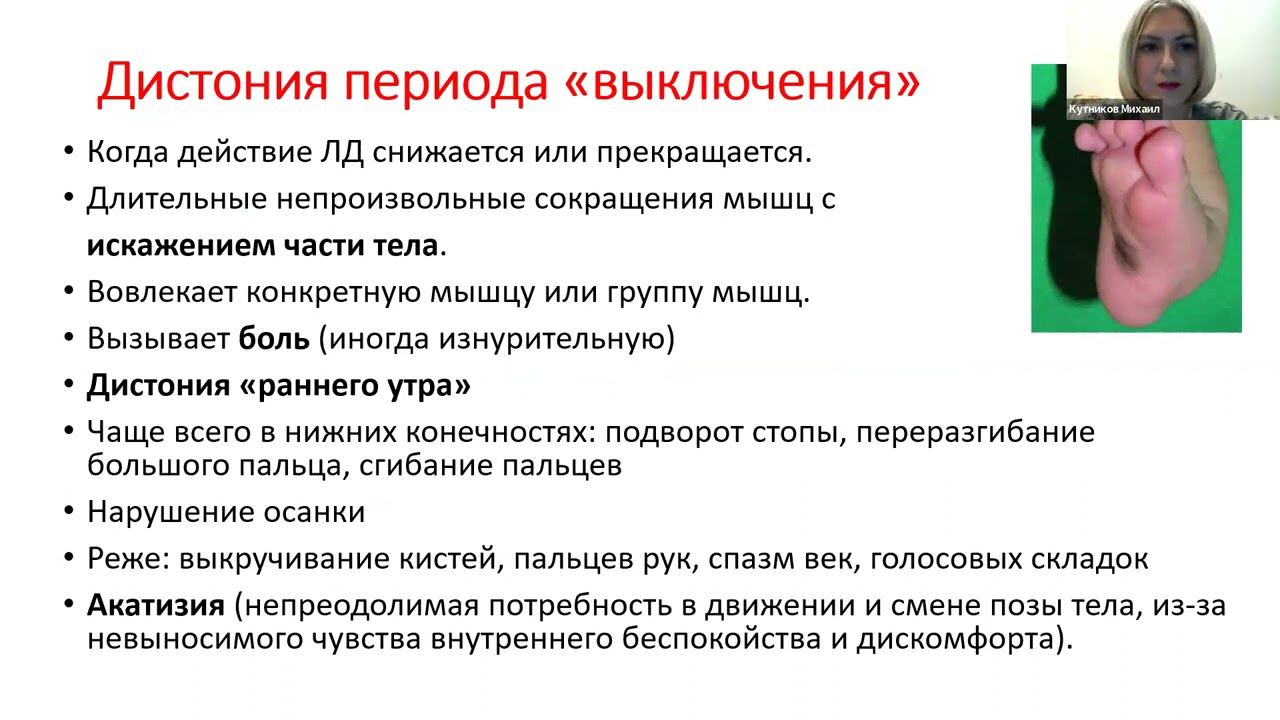 Дискинезии при болезни Паркинсона. Лекция и ответы на вопросы слушателей от паркинсонолога смотреть онлайн