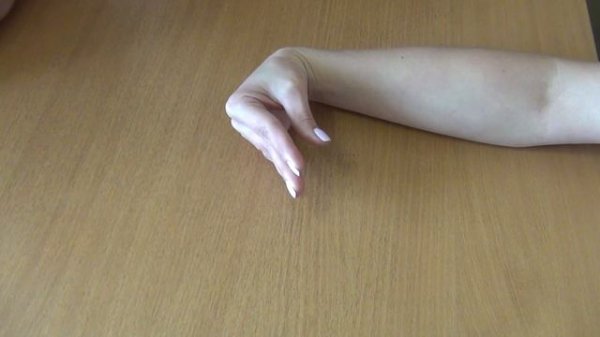 Тест Фалена / Phalen test