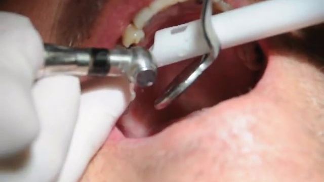 TOOTH DOCTOR IS IN XXX смотреть онлайн