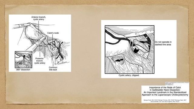 Lund lymph node смотреть онлайн