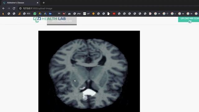 Concurrent Validity of Zeno Instrumented Walkway and Video Based Gait Features in Adults With Parki смотреть онлайн