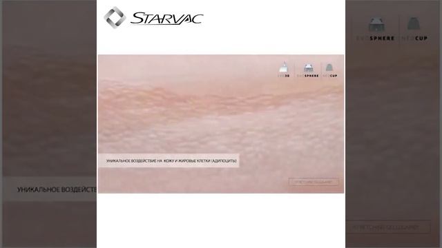 Вакуумно-роликовый массаж Starvac с запатентованной насадкой EVO3D смотреть онлайн