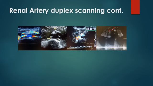 Ultrasound imaging of the renal artery смотреть онлайн