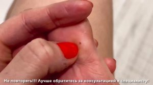 Удалила стержневую мозоль дома Результат в описании