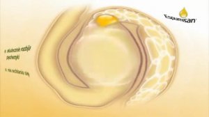 Espumisan przechodzi w 4 gęstość