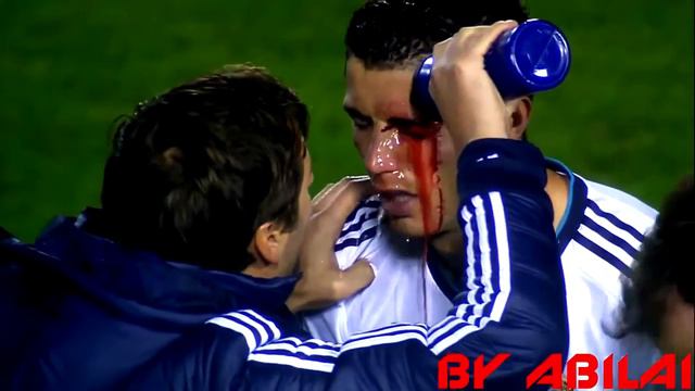 Роналду разбили лицо смотреть онлайн