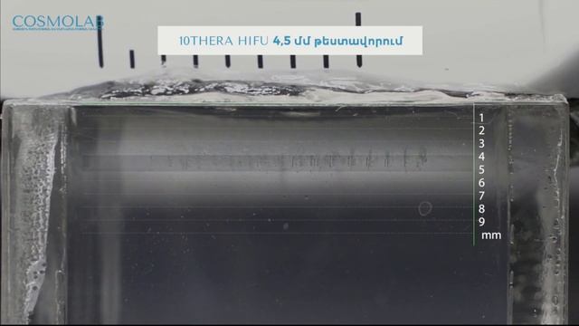 HIFU Lifting | Մաշկի ոչ վիրահատական ձգում смотреть онлайн