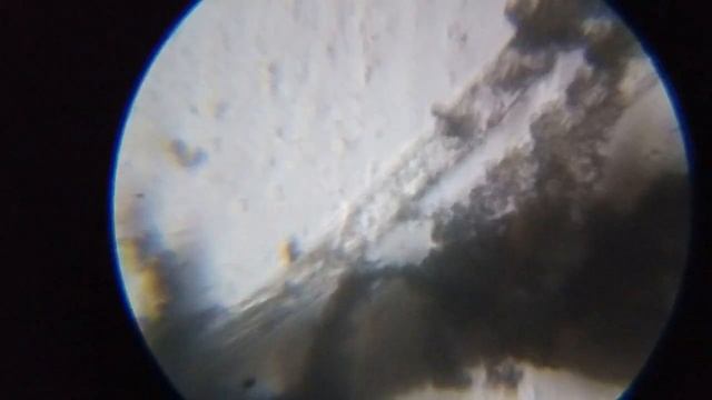 Под микроскопом - Черная плесень смотреть онлайн