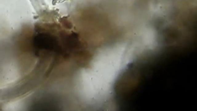 Nematode lassoed by a fungi смотреть онлайн