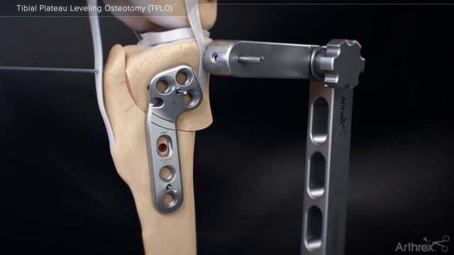 Tibial Plateau Leveling Osteotomy (TPLO)