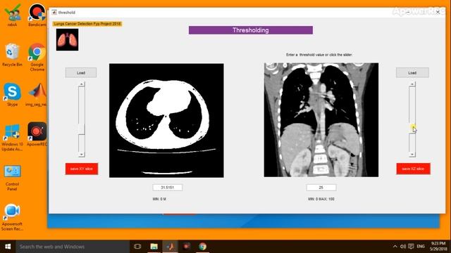 FYP 2018- 3D RECONSTRUCTION AND IDENTIFICATION OF LUNGS TUMOR FROM CT SCAN USING MACHINE LEARNING смотреть онлайн
