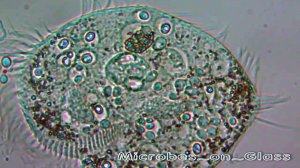 Гибель инфузории. Инфузория под микроскопом.