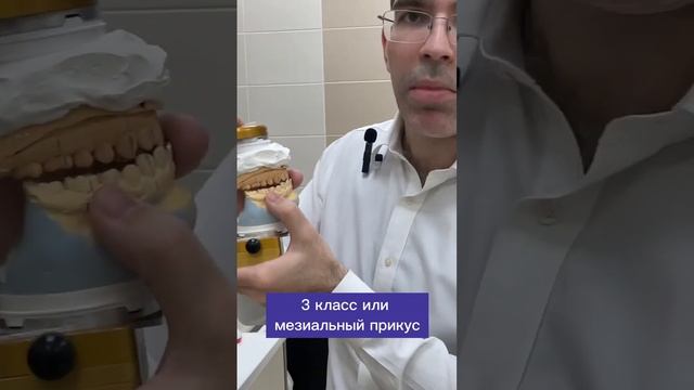 Какой прикус правильный, а какой патологический? смотреть онлайн