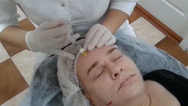 Биоревитализация с помощью иглы и канюли -сочетанная техника смотреть онлайн