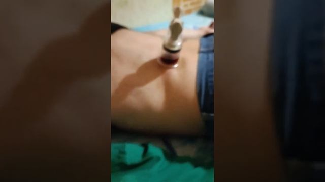 хиджама поясницы смотреть онлайн