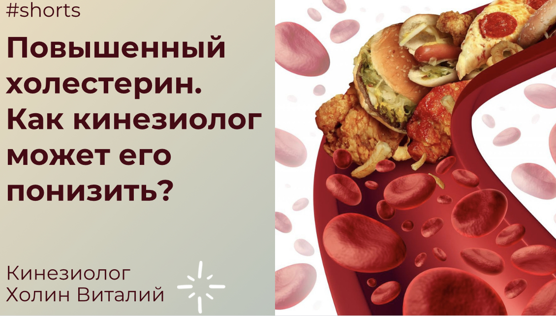 Повышенный холестерин. Как кинезиолог может его понизить? смотреть онлайн