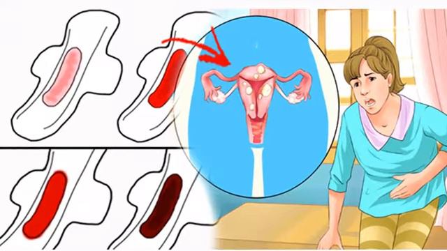 Не время ждать: симптомы, которые говорят о проблемах с женскими органами смотреть онлайн