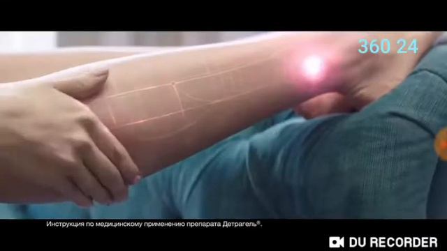 Детралекс смотреть онлайн