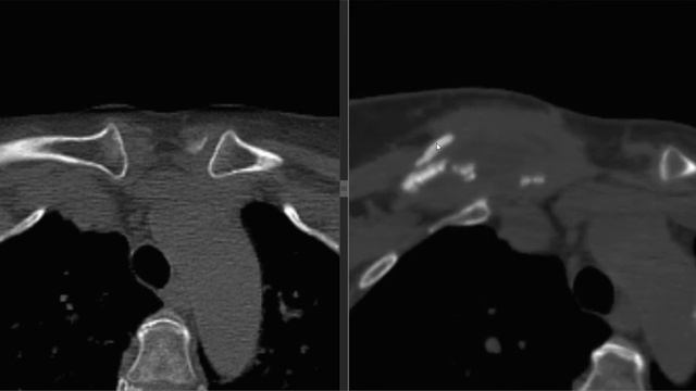 Всегда бери с собой медицинскую документацию! смотреть онлайн