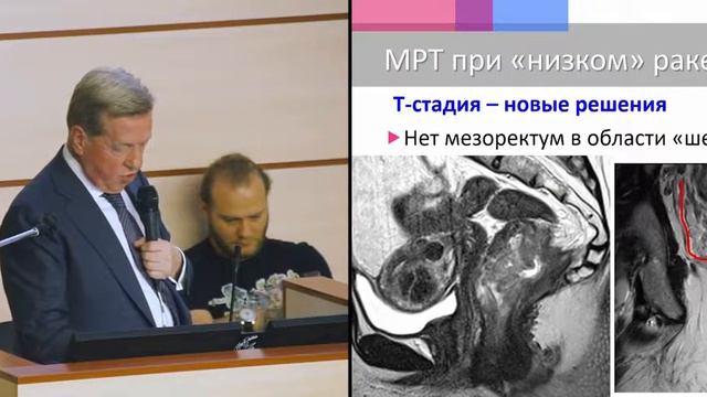 III конгресс РОСКР. П.В.Царьков: Интерсфинктерная резекция прямой кишки смотреть онлайн