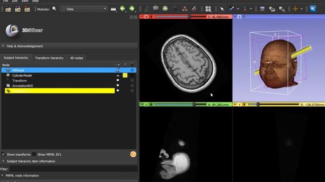 Transforming objects using Data module in 3D Slicer смотреть онлайн