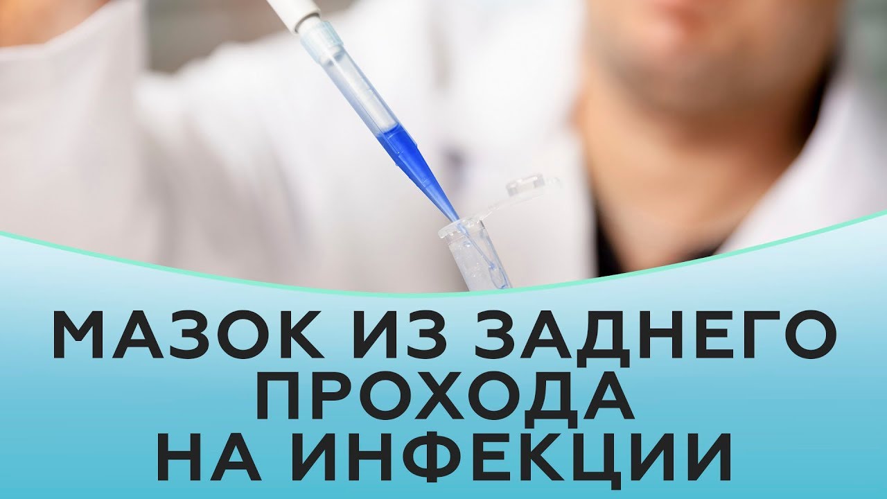 Как взять мазок из заднего прохода на инфекции смотреть онлайн