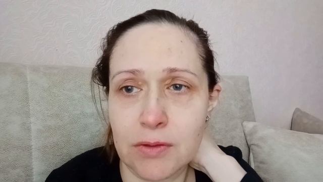 РАССТРОИЛАСЬ: Как же удалить КСАНТЕЛАЗМЫ? смотреть онлайн