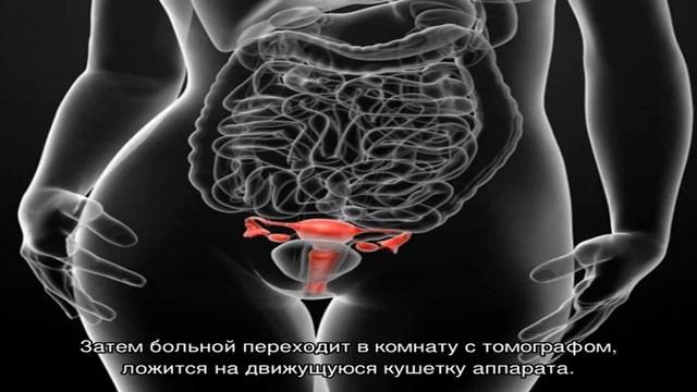 КТ органов малого таза - цены в Москве смотреть онлайн
