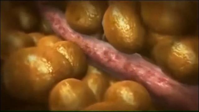 revita shape v8+cavi с технологией velashape смотреть онлайн