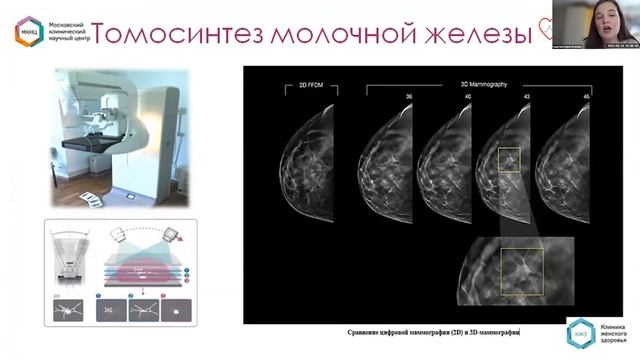 Роль сестринского персонала в диагностике рака молочной железы. смотреть онлайн