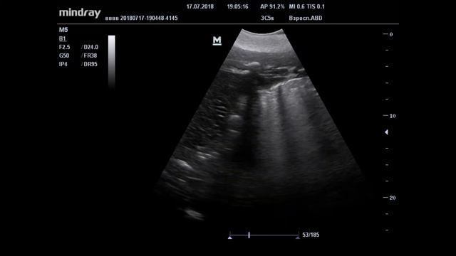 УЗИ ЖКТ у дельфина смотреть онлайн