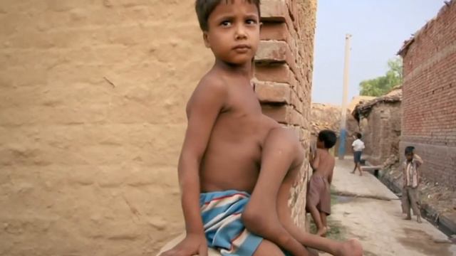 One In a Billion! People Born With Extra Body Parts смотреть онлайн