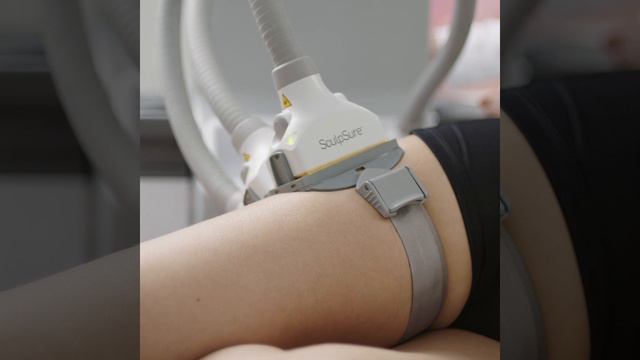 WarmSculpting by SculpSure: What Areas of the Body Can Be Treated? смотреть онлайн