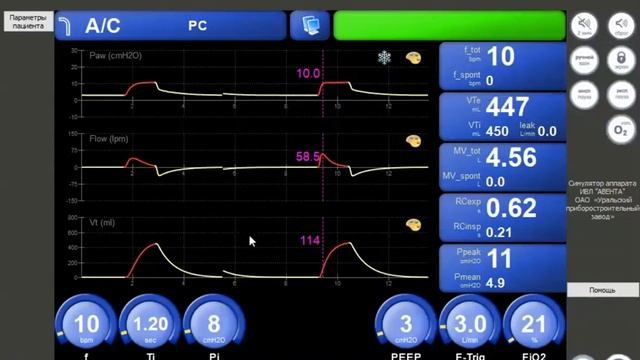 Симулятор АВЕНТА-А_С-CMV-PC (Л.№2) Горячев А.С