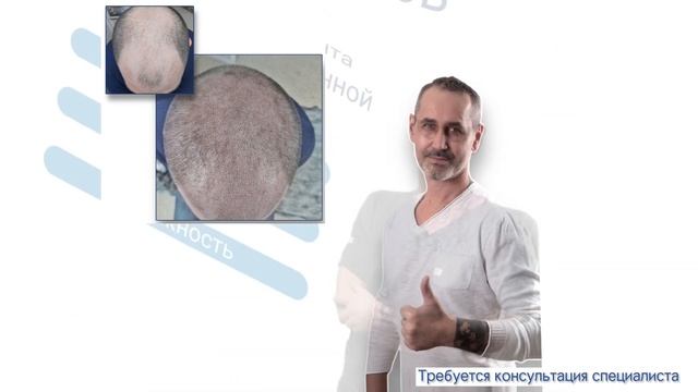 Трихопигментация Новосибирск смотреть онлайн